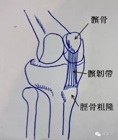 膝盖痛的简易鉴别