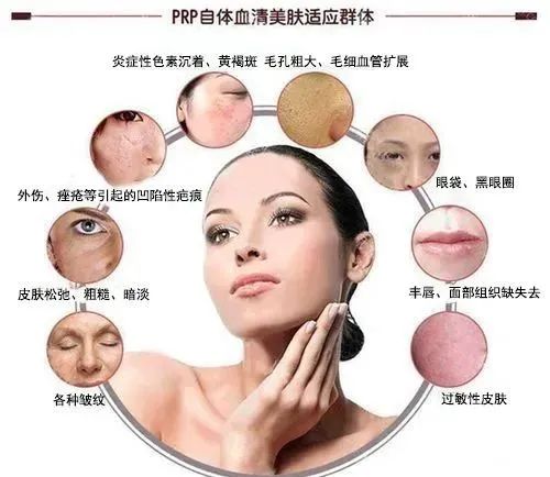 全国第十七届PRP技术骨病疼痛及美容临床应用研修班-小辉娱乐网