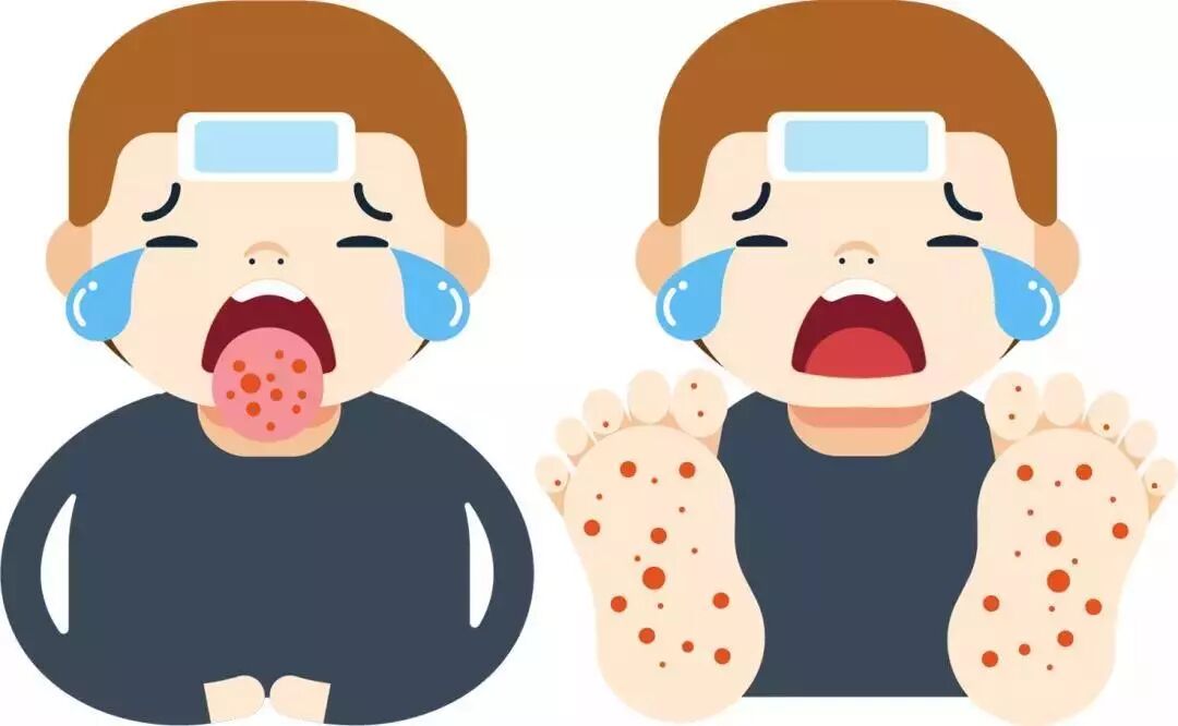 手足口那些事,家长早知道,孩子少受罪!-爱妻自媒体