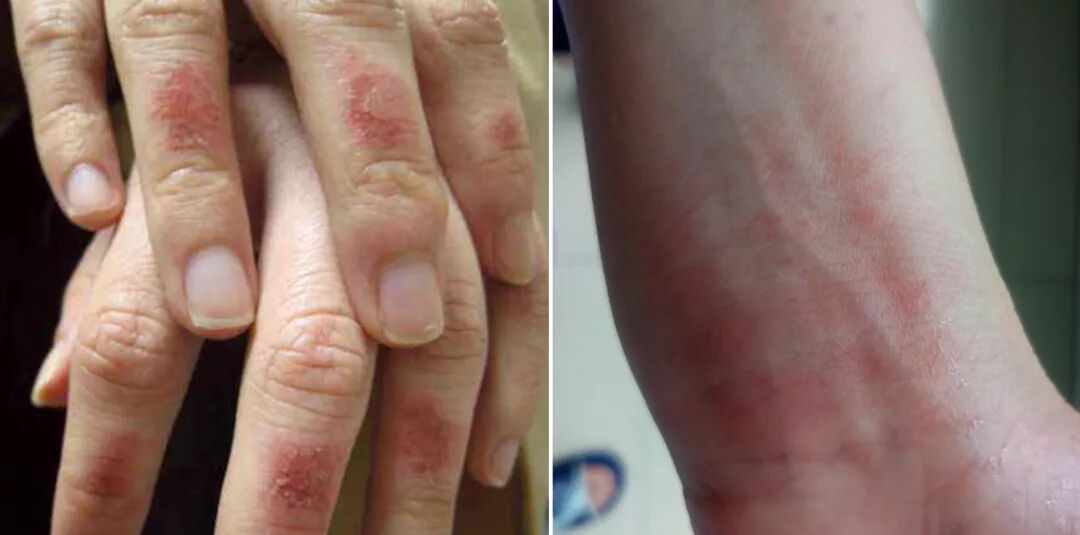 芒果台强捧搭上土豪都没火自己作死抢一姐风头反被打压