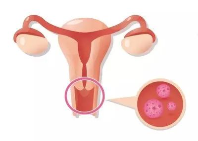 中国癌症地图出炉！这些癌广东人易得，教你防范→-小辉娱乐网