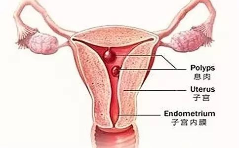 异常子宫出血的9种情况都在这里！