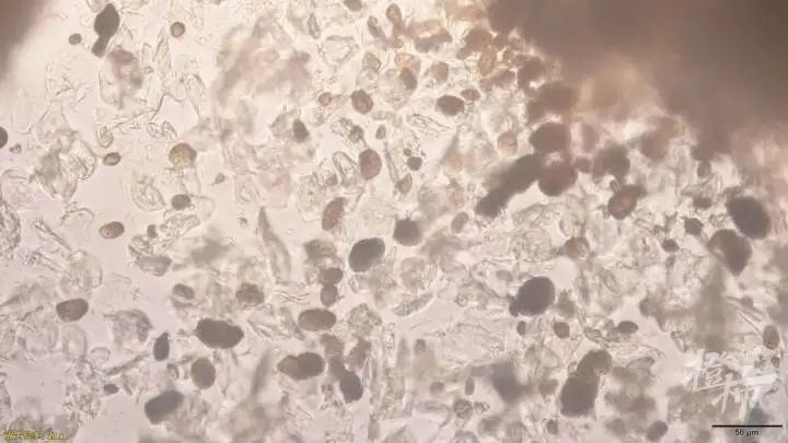 一家四口全中招！一到晚上痒到怀疑人生，“抓得满是血痕”，一查竟是…-小辉娱乐网