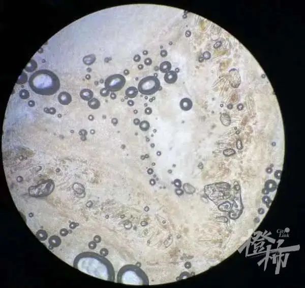 一家四口全中招！一到晚上痒到怀疑人生，“抓得满是血痕”，一查竟是…-小辉娱乐网