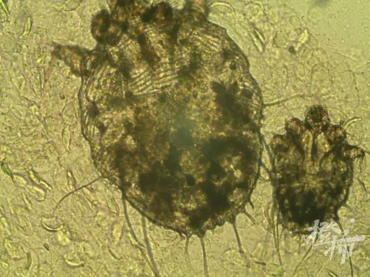 一家四口全中招！一到晚上痒到怀疑人生，“抓得满是血痕”，一查竟是…-小辉娱乐网