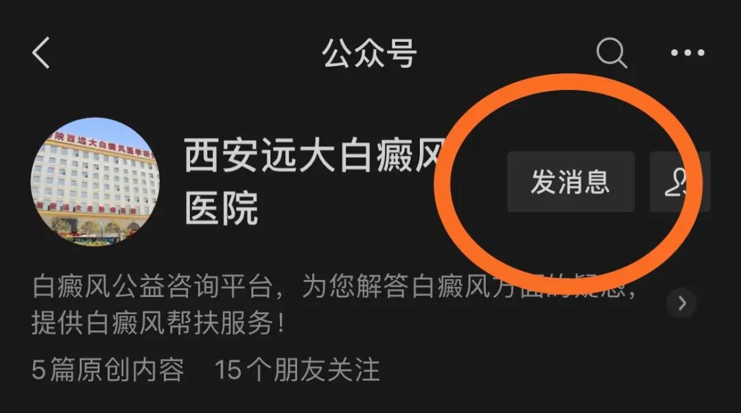 白癜风提升免疫力的“诀窍”，快试试这些方法！
