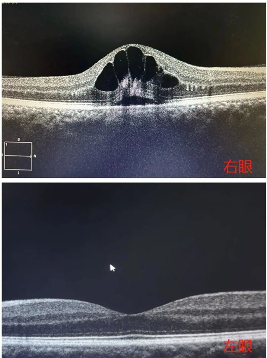 已有人中招！长假务必小心！-小辉娱乐网