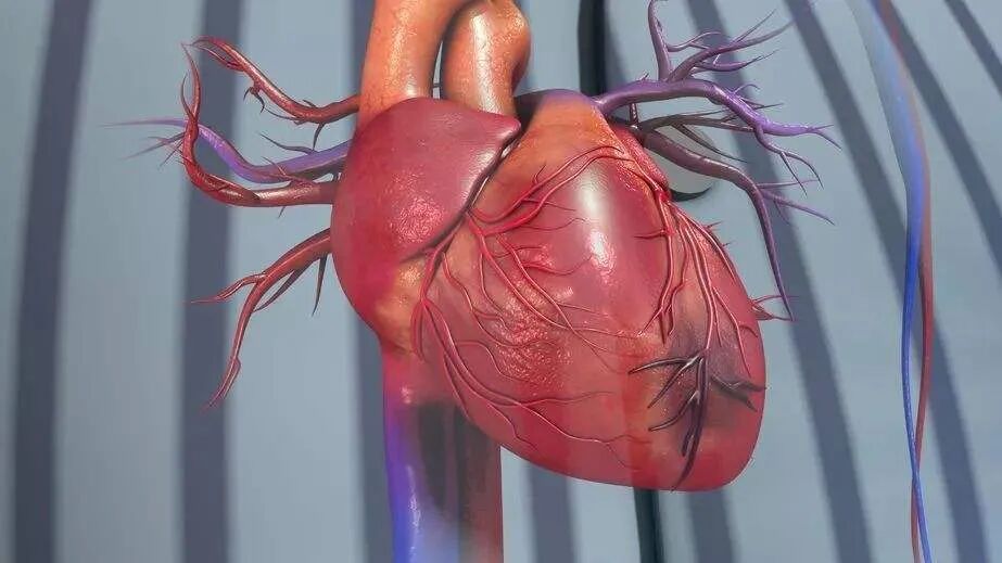 什么是下壁心肌梗死陈旧性心肌梗死要怎么治疗