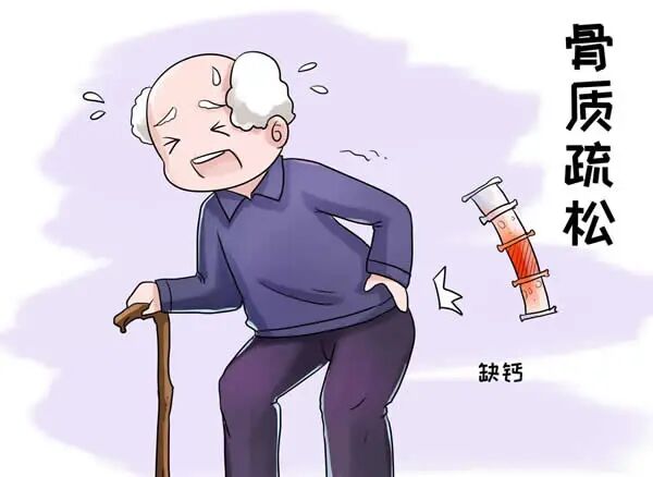 三减三健 | 让骨质不再松，这两条要坚持！-小辉娱乐网