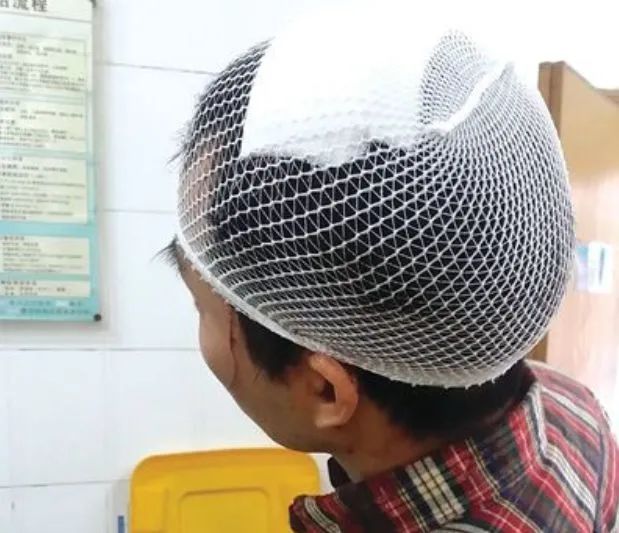 云南男子被妻子按摩到吐血，去医院检查，医生：你脑子里有把刀-小辉娱乐网