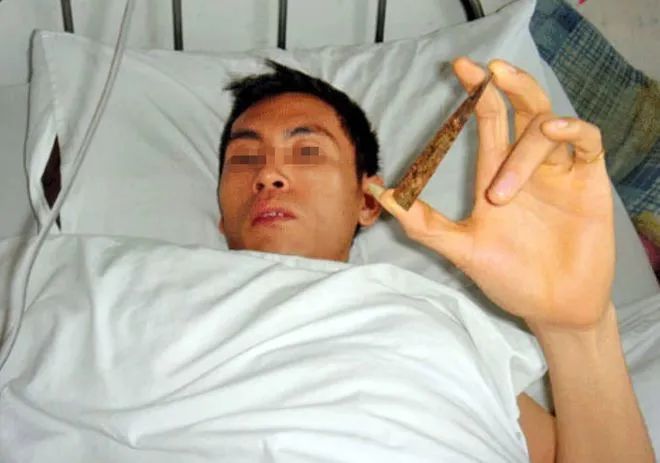 云南男子被妻子按摩到吐血，去医院检查，医生：你脑子里有把刀-小辉娱乐网