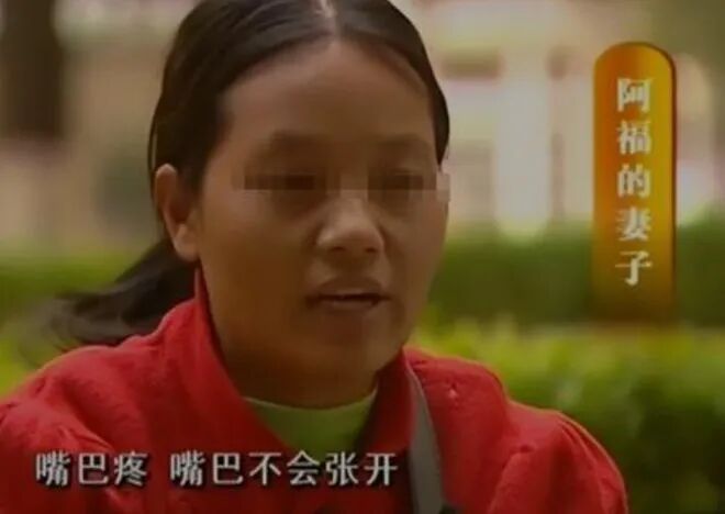 云南男子被妻子按摩到吐血，去医院检查，医生：你脑子里有把刀-小辉娱乐网