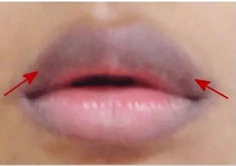 女人这两处越黑子宫越脏？不想炎症缠身，别视而不见！-小辉娱乐网