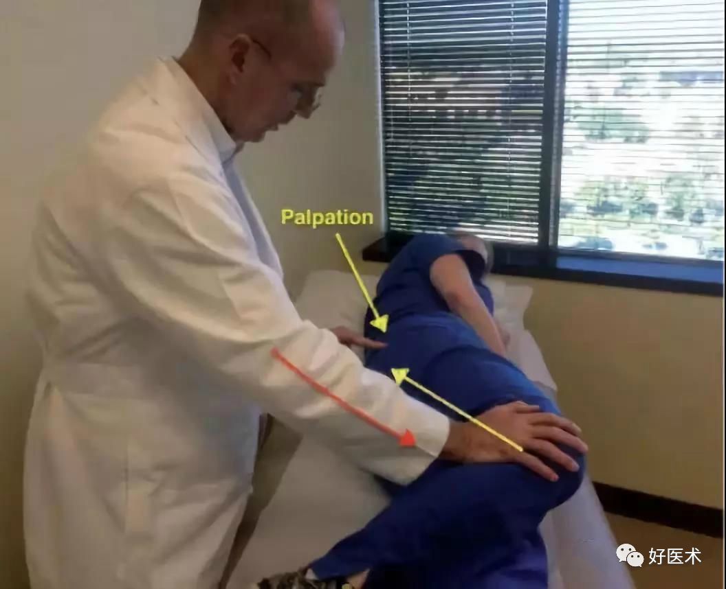 梨状肌综合征的解剖评估诊断及康复治疗