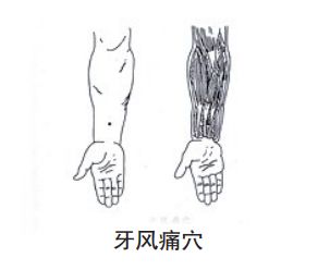 【针灸】这8个穴位针灸止痛有奇效，快学起来~-小辉娱乐网