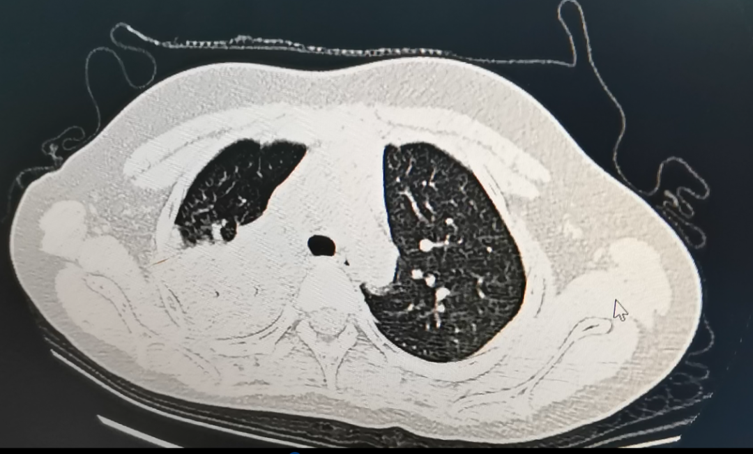 下月或达感染高峰，一地疾控紧急提醒！这两种药完全无效-小辉娱乐网