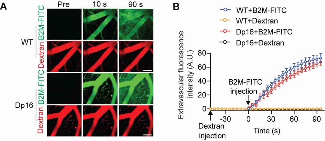 厦门大学又一篇Cell：王鑫团队揭示唐氏综合征认知损伤新机制-小辉娱乐网