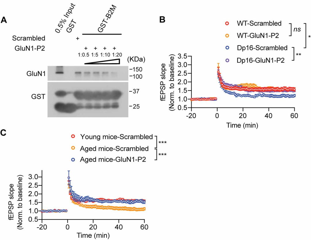 厦门大学又一篇Cell：王鑫团队揭示唐氏综合征认知损伤新机制-小辉娱乐网