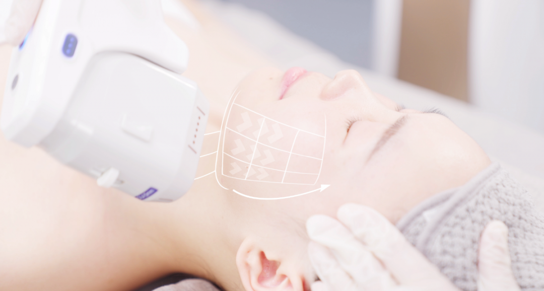 惠州震撼首发——超声王 技术升级 胶原“新”设备-小辉娱乐网