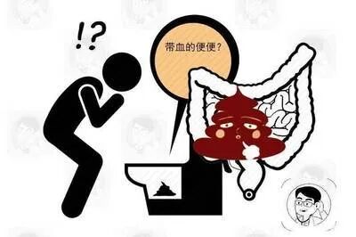 【扩散】19岁泸州小伙患肠癌，大便这些情况，需注意……-小辉娱乐网