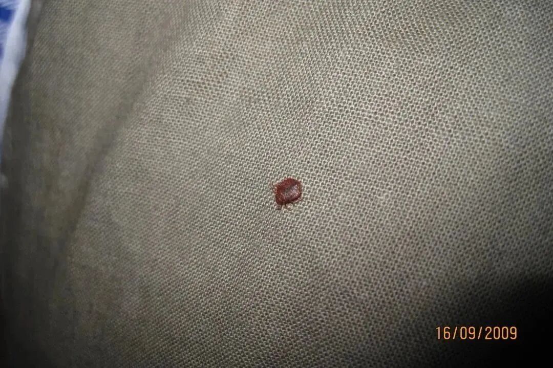 多国爆发！已蔓延至亚洲-小辉娱乐网