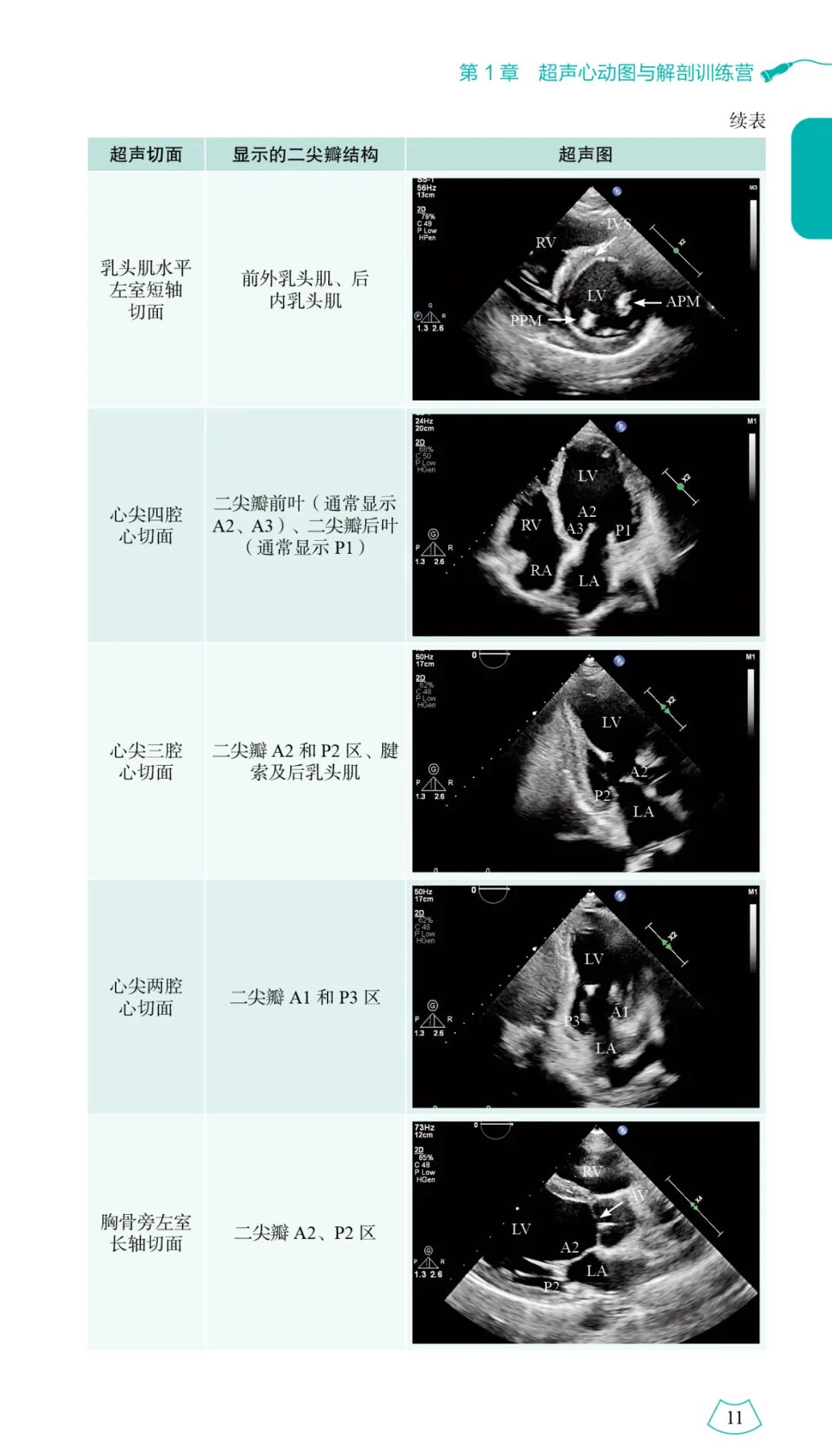 『新书推荐』《心超一点通：超声心动图实战训练营手册》一本难得的超声心动图临床和科研用书-小辉娱乐网