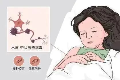 水痘高发期，战“痘”攻略快备好-小辉娱乐网