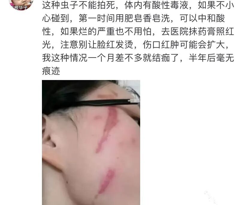 警惕！洛阳多人就诊！河南多地已发现-小辉娱乐网