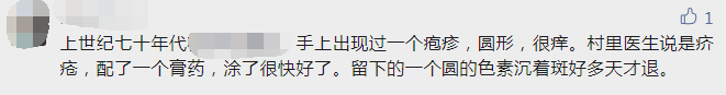 一家四口全中招！一到晚上痒到怀疑人生，“抓得满是血痕”，一查竟是…-小辉娱乐网