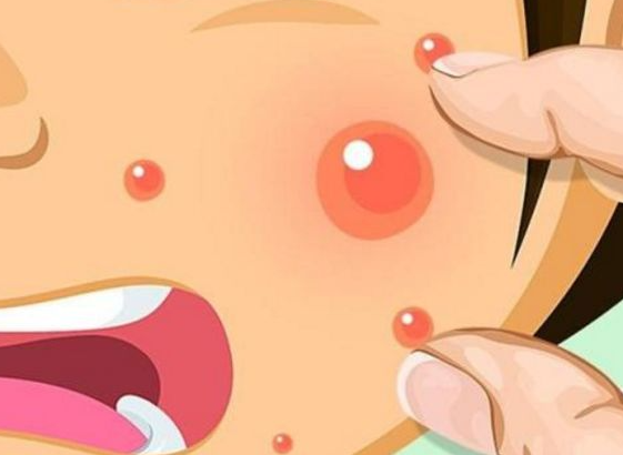 【肤康科普】祛痘方法要正确，这些事长痘不能做