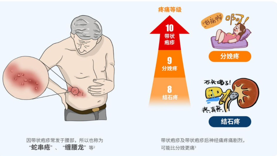 这种病疼起来堪比分娩